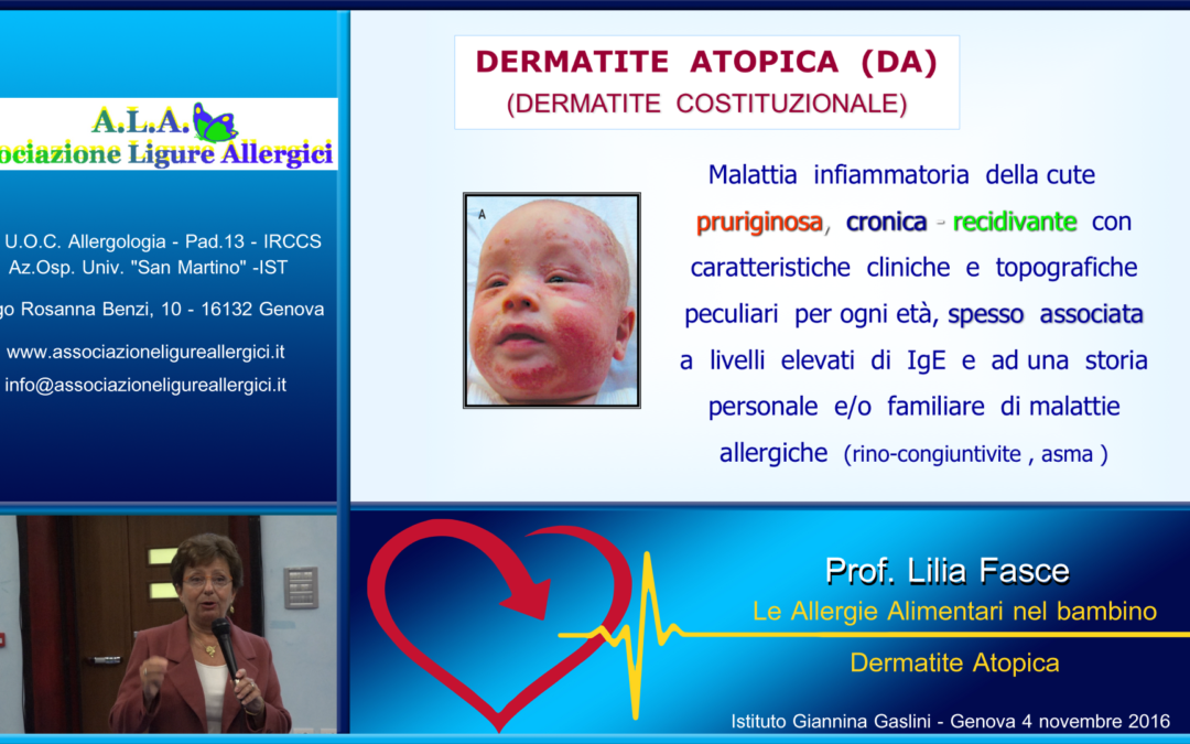 Dermatite atopica